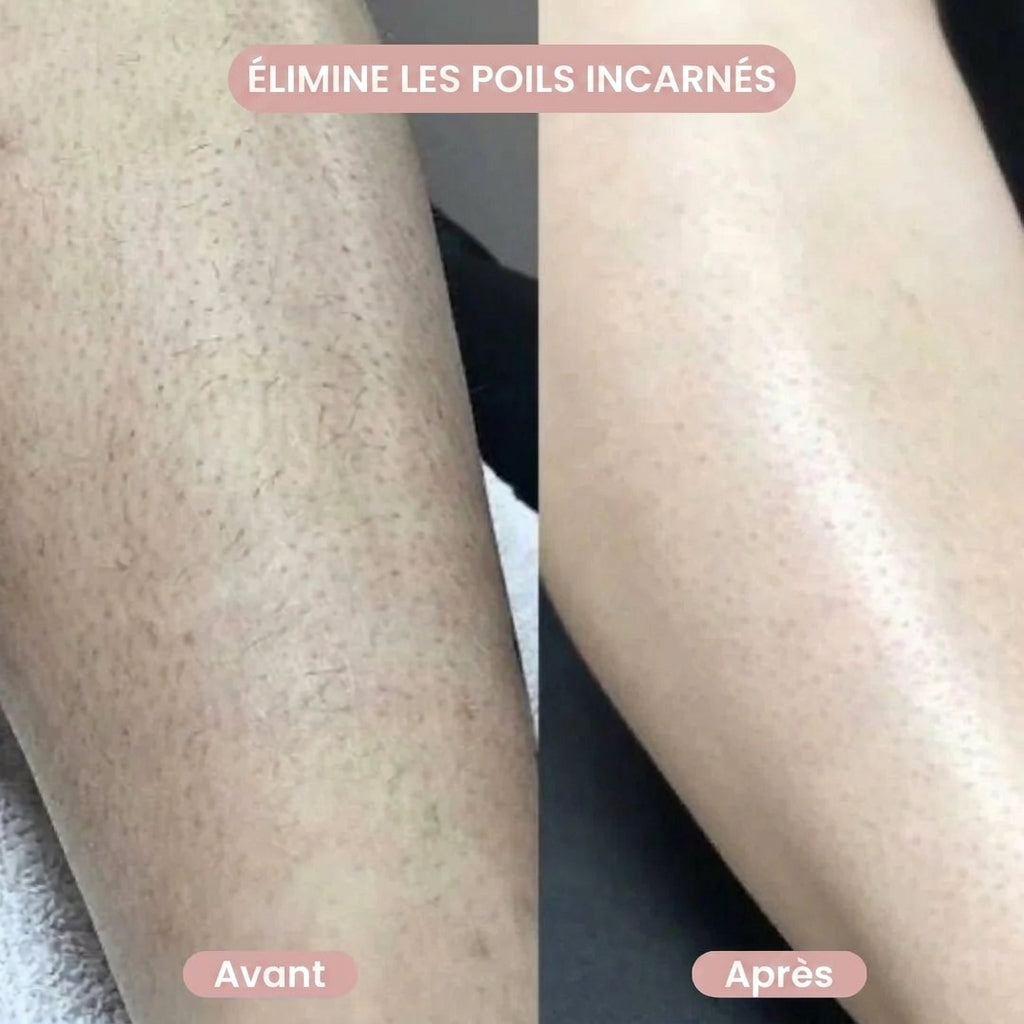 Liscéa - Rasoir 2-en-1 Maillot & Corps