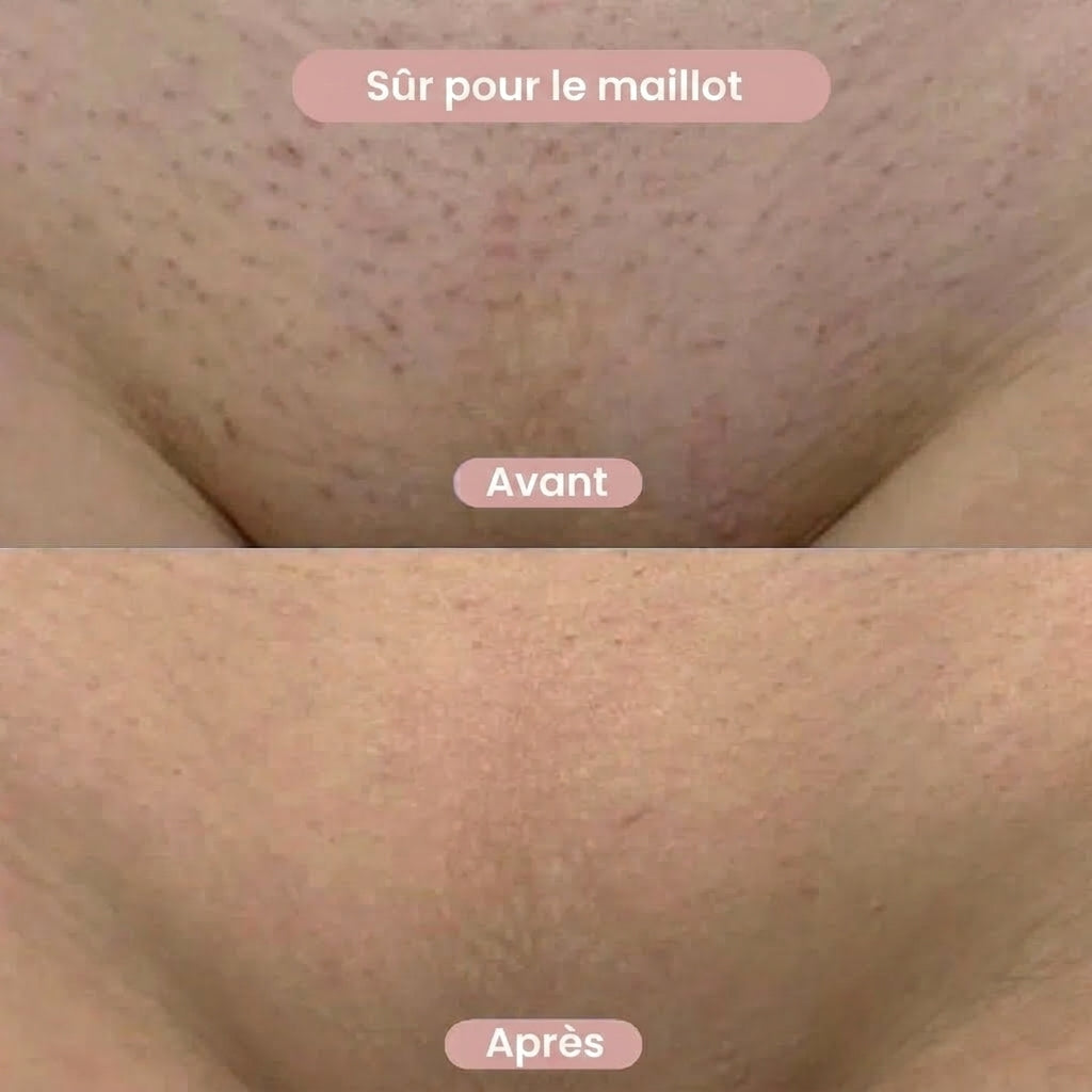 Liscéa - Rasoir 2-en-1 Maillot & Corps